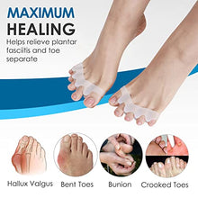 Load image into Gallery viewer, Toe Separators for Overlapping Toes, Gel Silicone Toe Straightener Corrector, Toe Spreader Spacers for Hallux Valgus Tailors Claw and Crooked Toes
