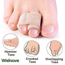 Load image into Gallery viewer, Welnove 6Pcs Hammer Toe Straightener, Hammer Toe Splints, Toe Cushioned Bandages for Correcting Hammer Toes, Broken Toes, Crooked Toes &amp; Overlapping Toes
