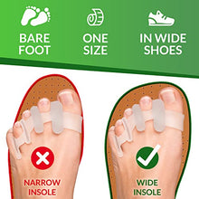 Load image into Gallery viewer, YogaMedic® Toe Separators for Overlapping Toes [6Pcs] to Relax Toes, Improved Gel Silicone, 0% BPA, One-Size, Spreader
