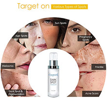 Load image into Gallery viewer, Dark Spot Remover for Face and Body, Reduces Hyperpigmentation, Age Spots, Sun Spot, Acne Scar with Kojic Acid, 4-Butylresorcinol, Lactic Acid. 1 fl oz.
