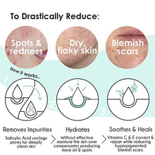 Load image into Gallery viewer, BeBarefaced Acne Treatment Acne Cream Moisturiser - Spot Cream Spot Treatment for Face with Tea Tree Oil and Salicylic Acid BHA - Anti Blemish Face Moisturiser - Women Mens Moisturiser Milia Treatment
